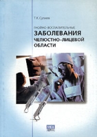 Гнойно-воспалительные заболевания челюстно-лицевой области артикул 6914d.